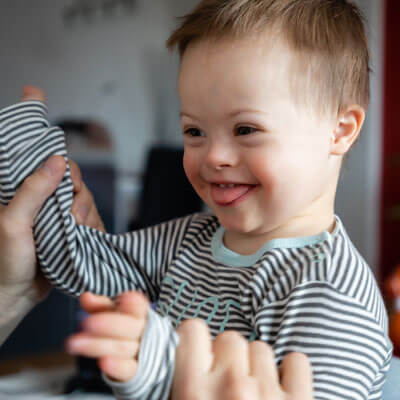 Baby with Down syndrome smiling