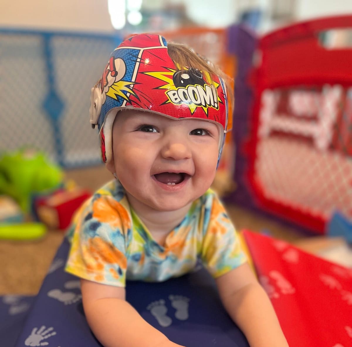 Flat Head Shape in Babies: What Helps Beyond a Helmet